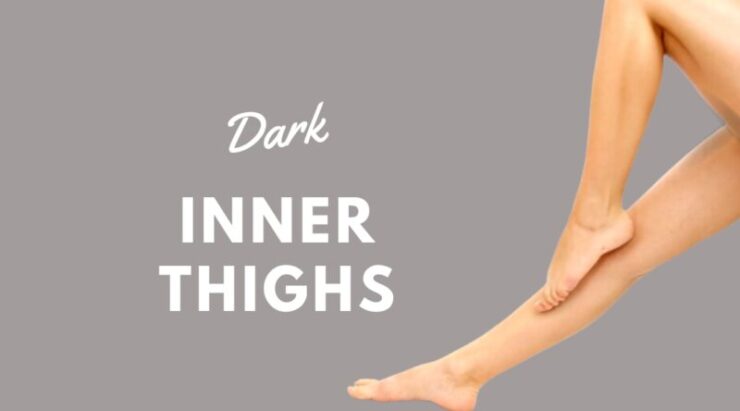 Dark Inner Thighs