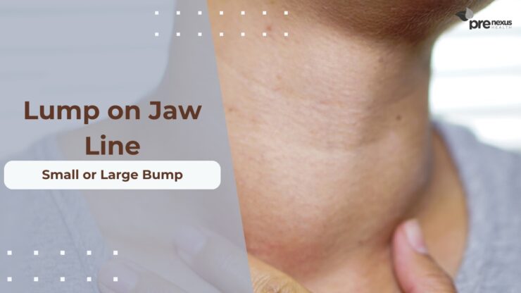 Jawline Lumps are Painful Near Ear