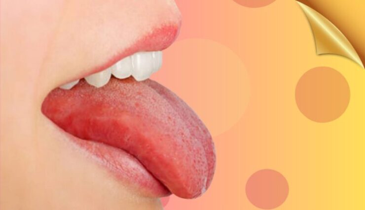 tongue pimples