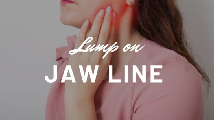 Lump on Jaw Line - Hard, Movable, Painful Near Ear, Small or Large Bump