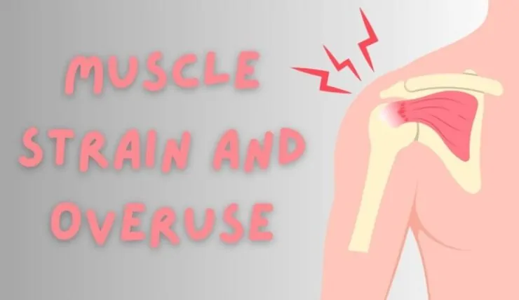 Muscle Strain and Overuse