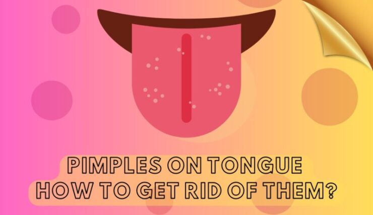 Pimples on Tongue