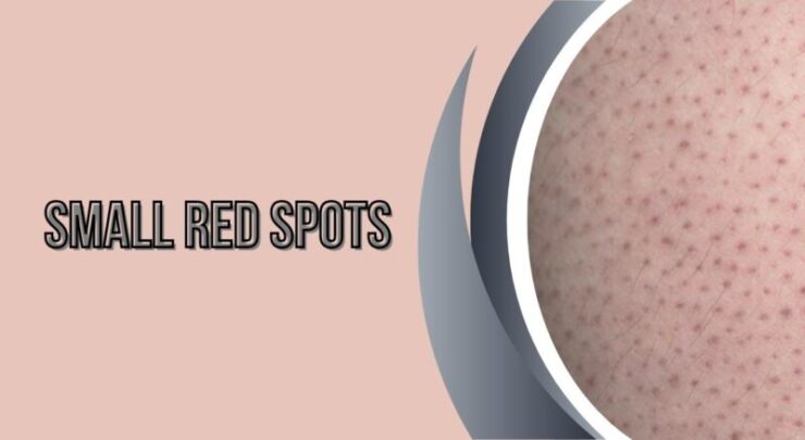 Small Red Spots