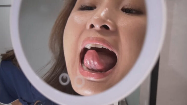 tongue mirror