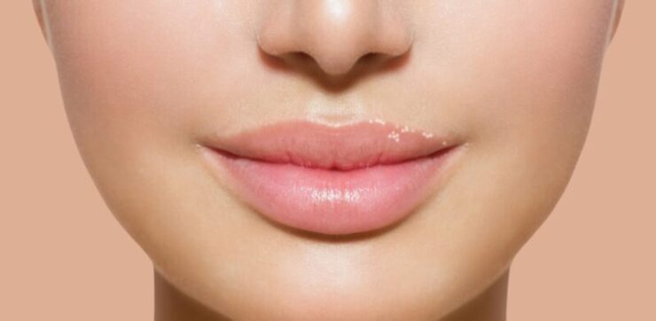 white spots on lips reasons