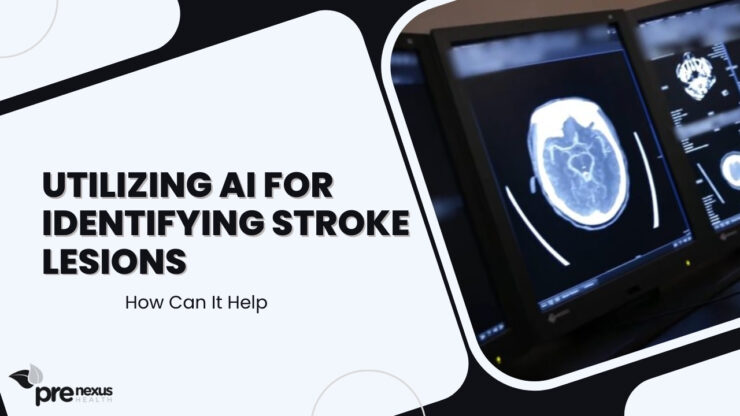 Role of artificial intelligence (AI) in the precise identification of stroke lesions
